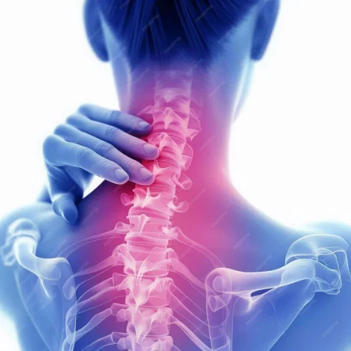 Spondylolisthesis