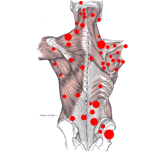 Sports Injury Assessment