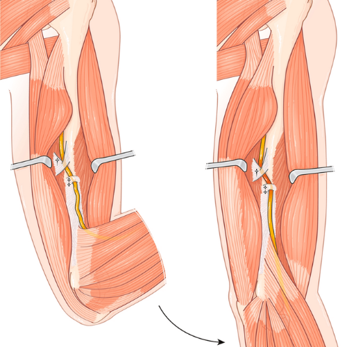 Injury Prevention Training