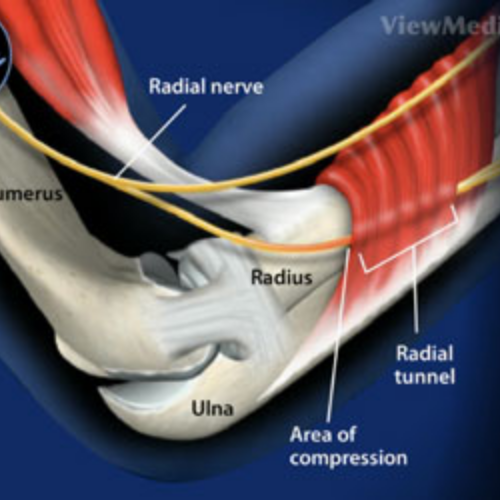 Injury Prevention Training