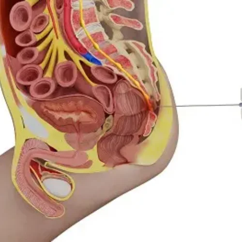 GANGLION IMPAR BLOCK