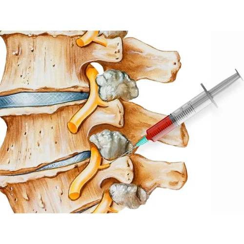 MEDIAL BRANCH BLOCK