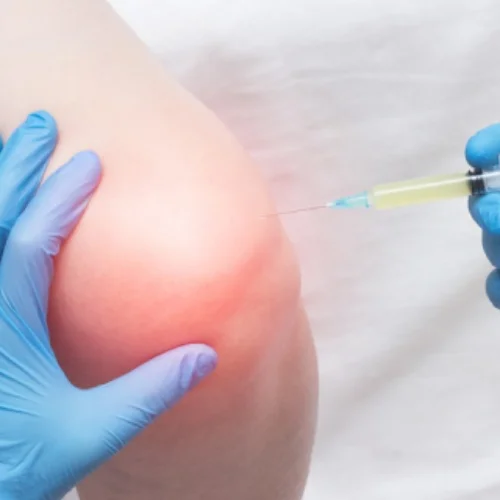 Prolotherapy