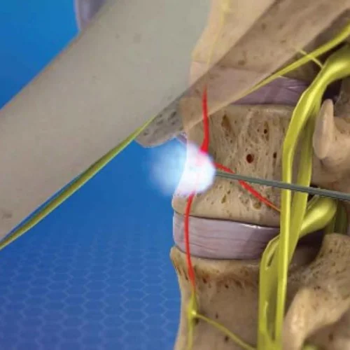 SYMPATHETIC NERVE BLOCK