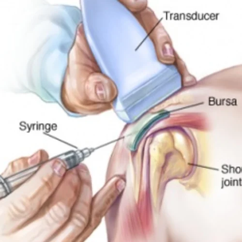 ultrasound-guided-joint-injections